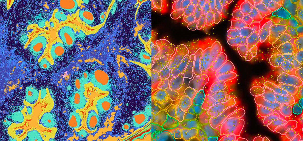 Spatial Multi-Omics Analysis 소개이미지